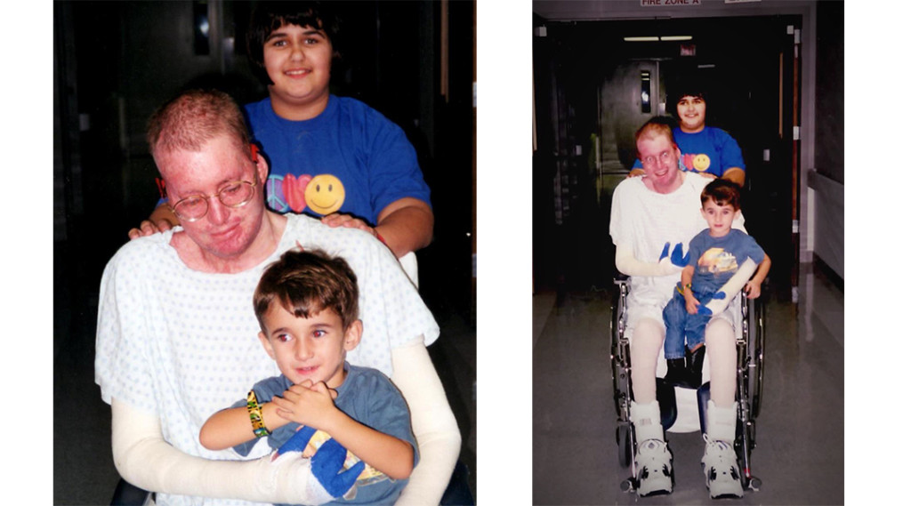 David Bowers with his children Nate and Samantha after burn accident